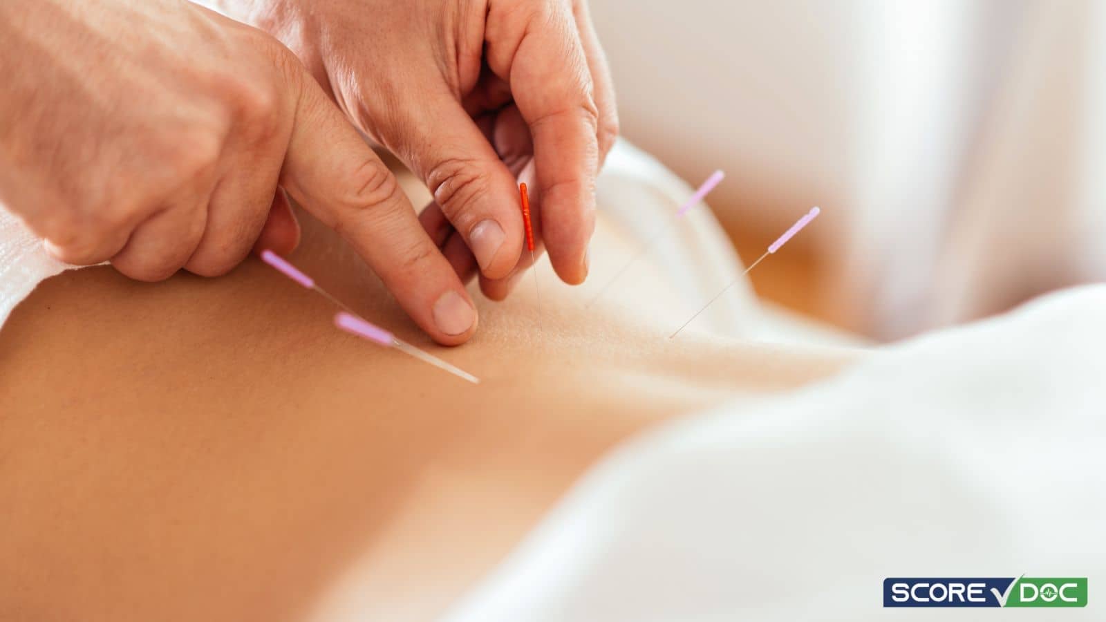 Acupuncture Clinics in Ann Arbor, MI