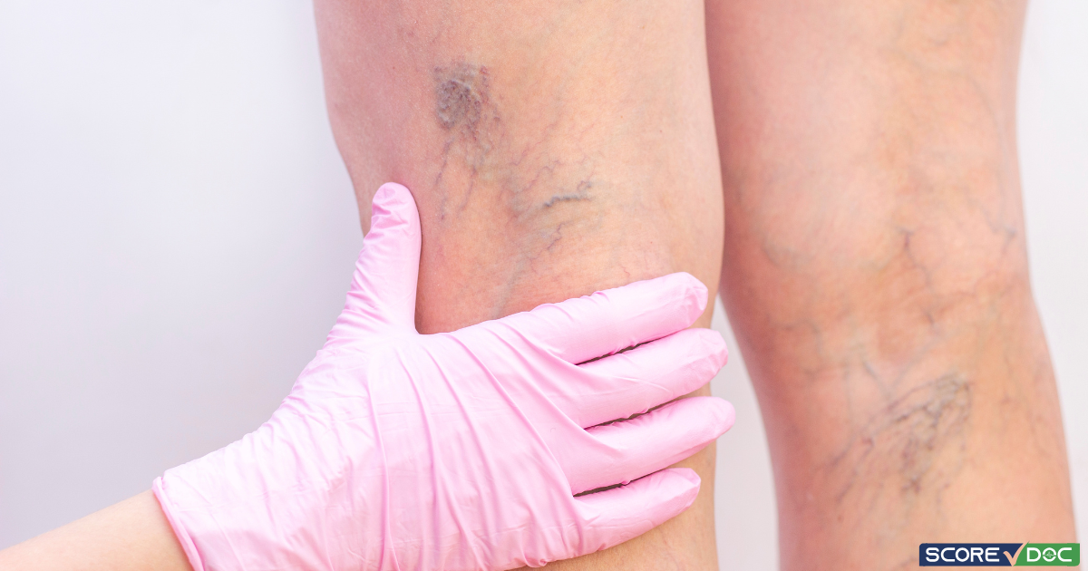 Best Vascular Surgery Clinics in Suwanee, GA
