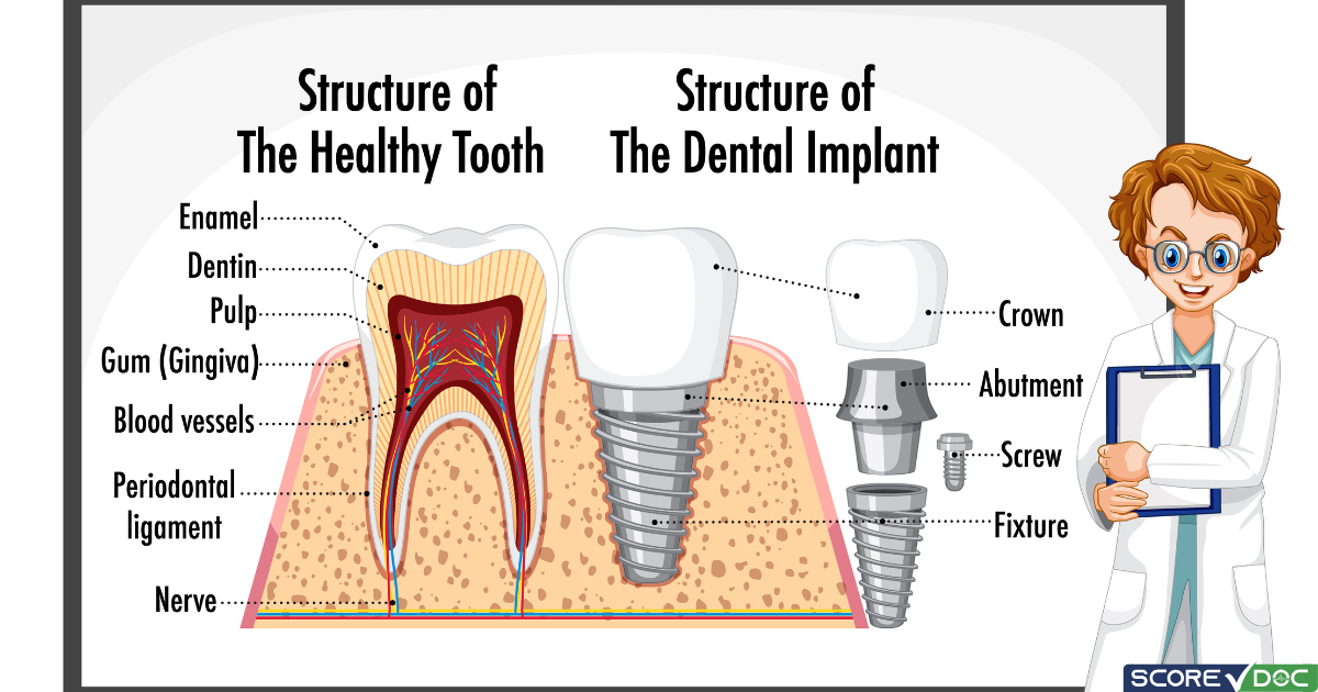 5 Best Rated Dental Implant Clinics in Nashville Metropolitan, TN