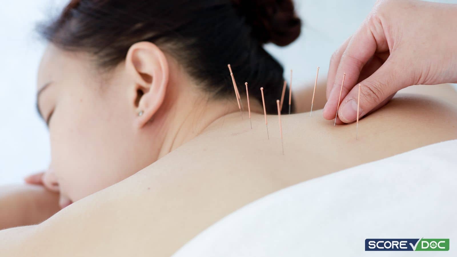 5 Top-Rated Acupuncture Centers in Orange, CA