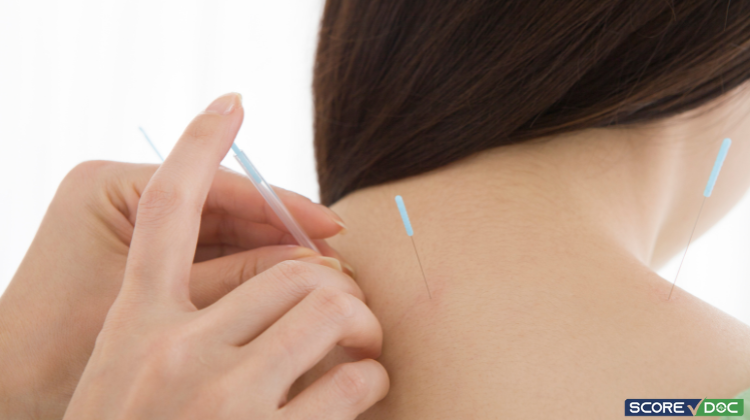 Top-Rated Acupuncture Centers in Stuart, FL